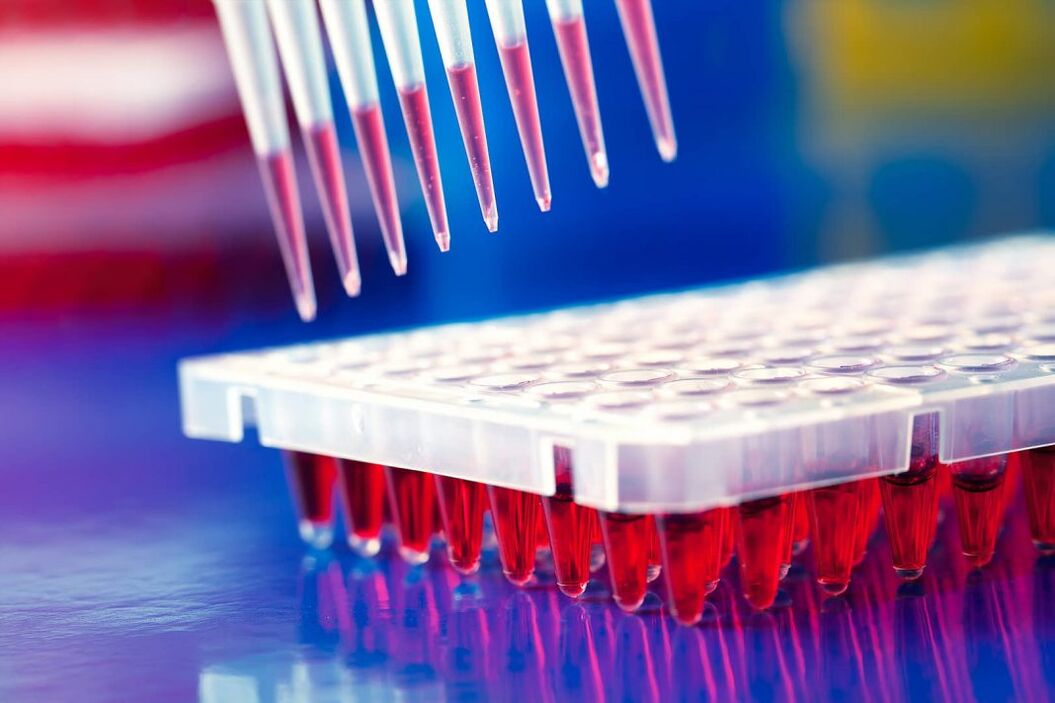 immunoassay blood test to detect parasites