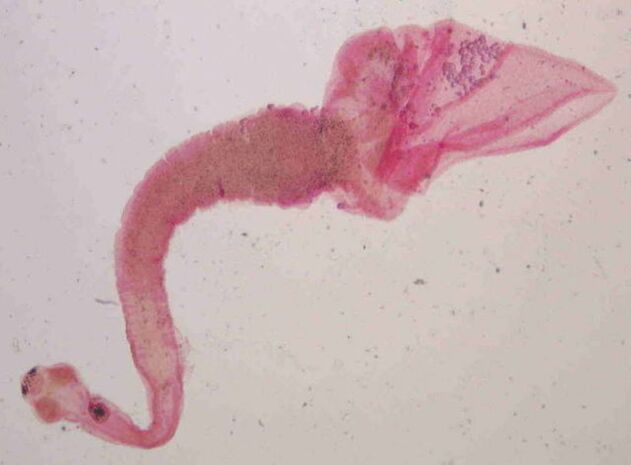 pig tapeworm from humans