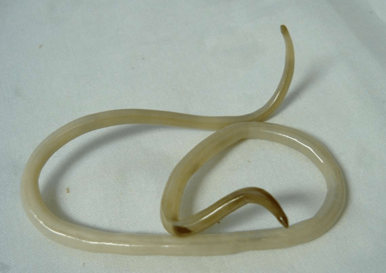 worm from the human body and its treatment