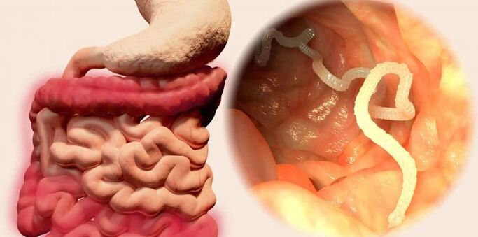 A worm is a parasite in humans